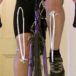 Cycling Knee Pain - Lateral Displacement